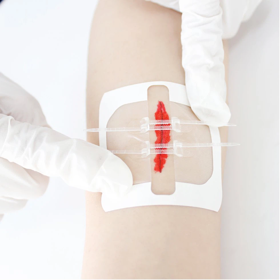 Emergency Protection Wound Closure Device