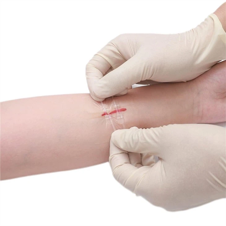 Closure Device